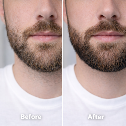 Beard Oil – Lightweight Daily Hydration